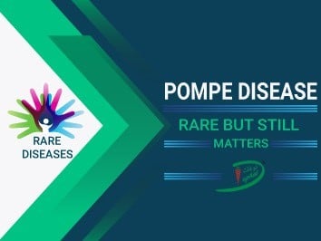 Pompe Disease – Rare but still Matters